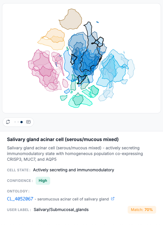 CyteType cluster detail showing Cell Ontology term mapping with UMAP visualization, confidence badge, CL reference link, cell state summary, and user label match percentage